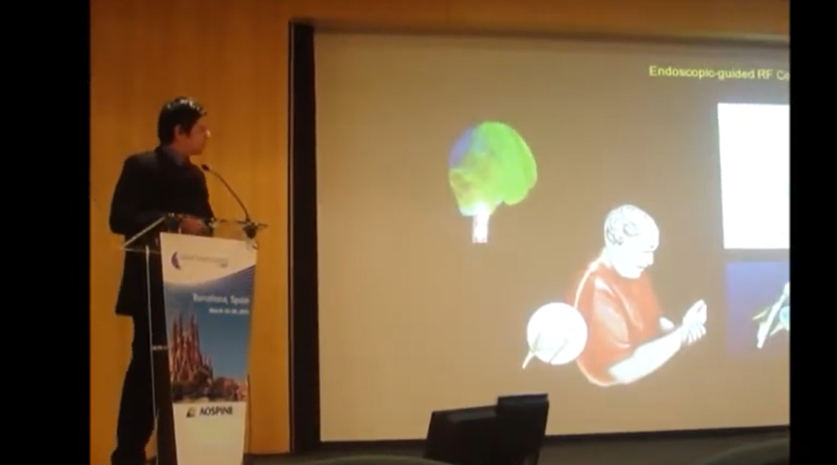 Endoscopic-guided radiofrequency cordotomy :: FONOFF - CONTRERAS - TEIXEIRA - YWZE - ALHO - NILTON